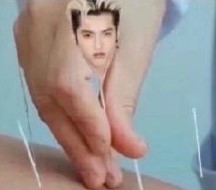 吴痛针灸表情包 吴痛针灸表情包