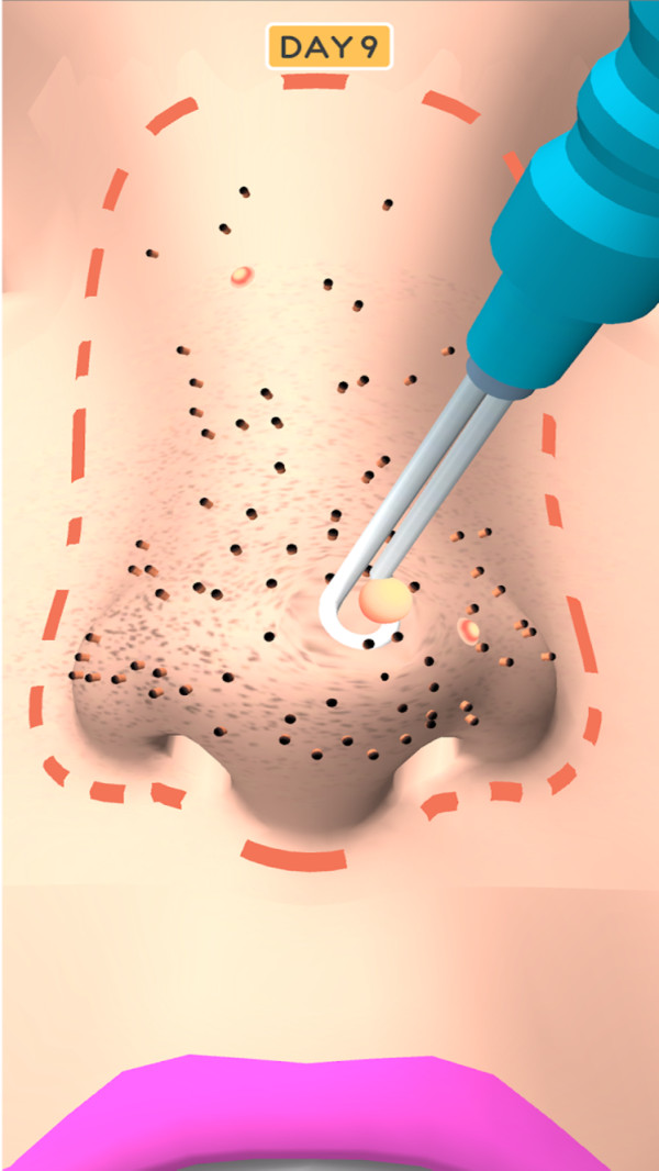 鼻子美容师-图3