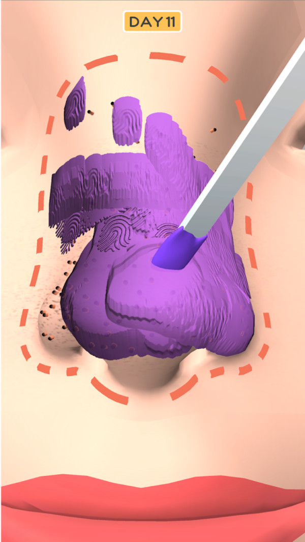 鼻子美容师-图2